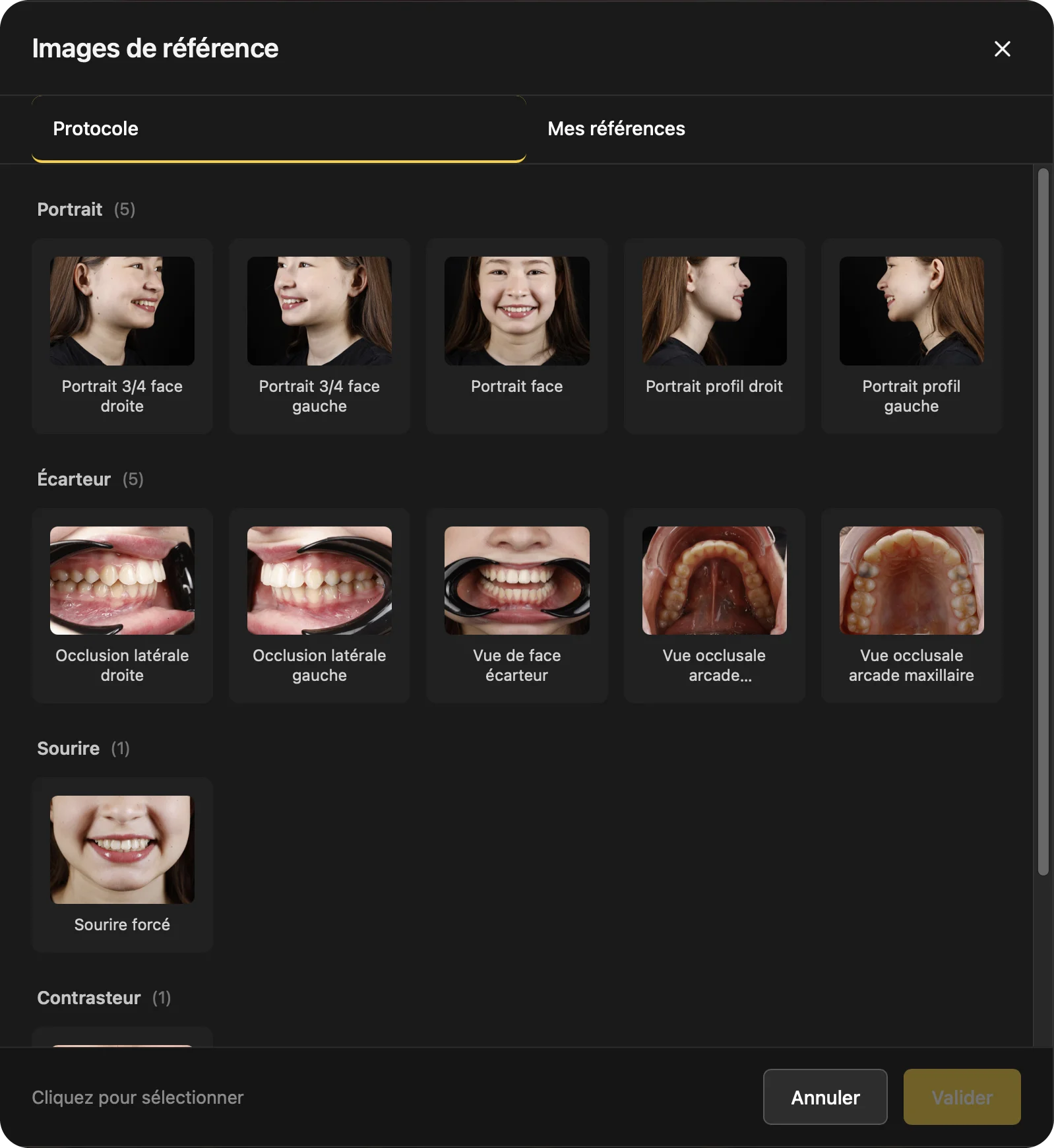 Logiciel U-SHOOT — images de référence, protocole de vues