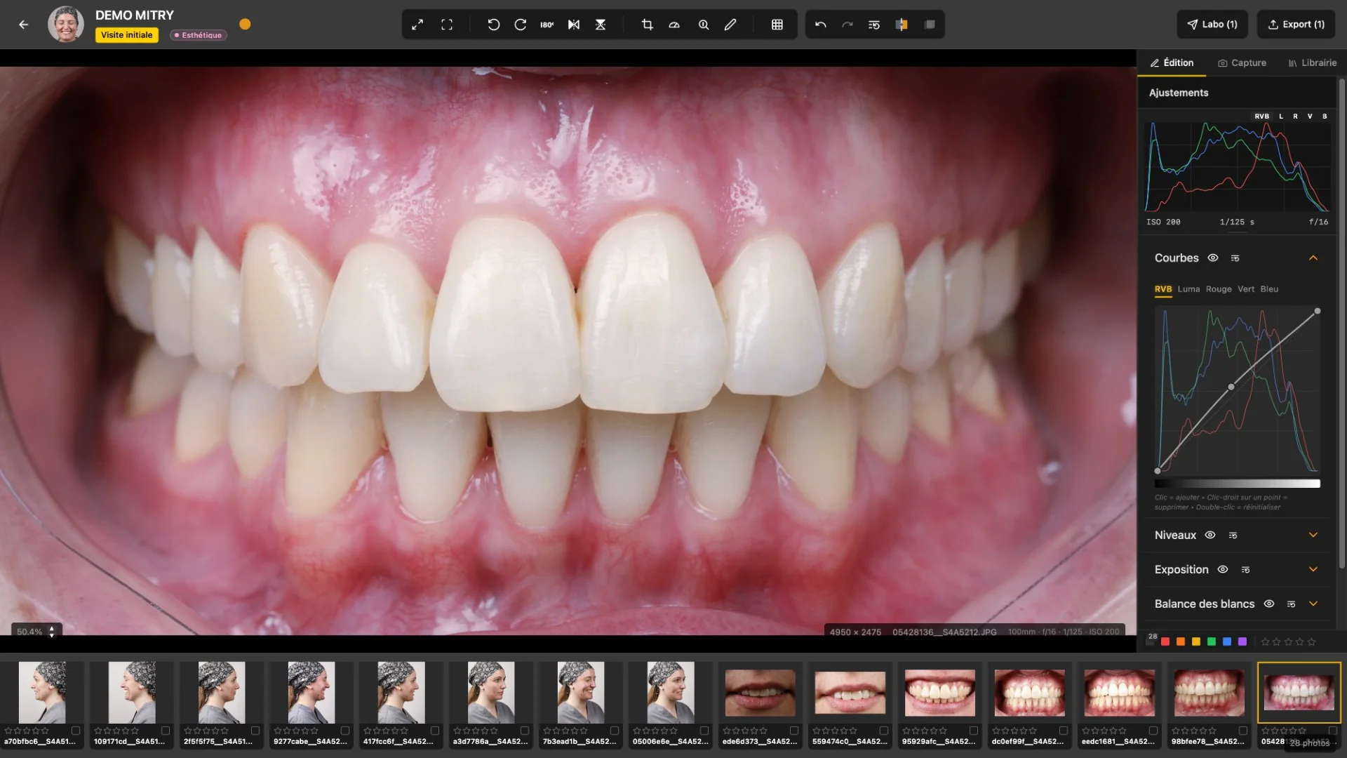 U-SHOOT — édition d'un cliché intra-oral avec histogramme et courbes RVB